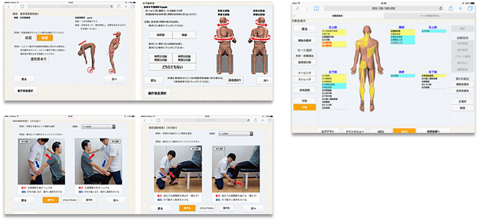 人工知能を利用したコンピューター解析EFAS